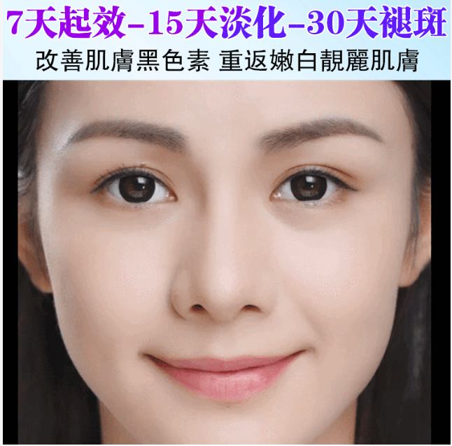 蘭花5D溶斑油